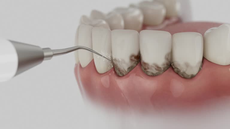 Reliable Dental Implants contractor in McConnell AFB, KS by Smile Center Dentistry